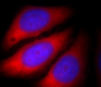Alpha Actin Antibody抗体，orb6246