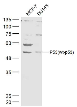 P53 (wt-p53) Rabbit Polyclonal