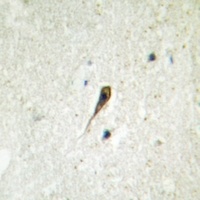 5-HT1A Antibody抗体，orb214069，bi