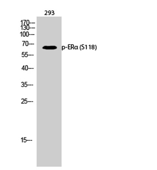 ERα (phospho Ser118) rabbit pA