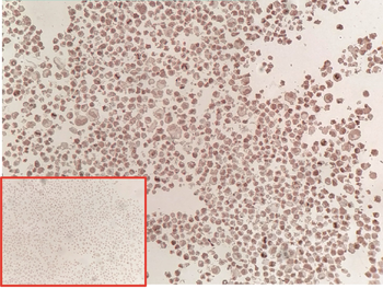 GPC3 Antibody抗体，orb2322342，bio