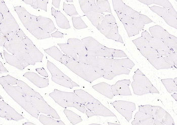 Cardiac Troponin I/TNIC Mouse 