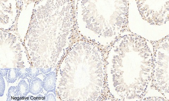 AP-1 (phospho Ser63) rabbit pA