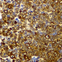 CD282 Antibody抗体，orb411837，bio