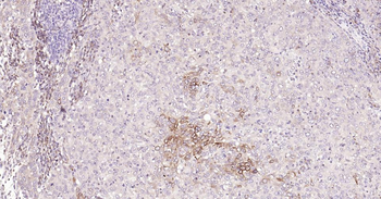 Bcl-2 Recombinant Rabbit Monoc