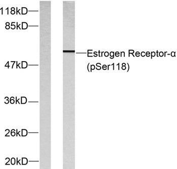 ERα (phospho Ser118) rabbit pA