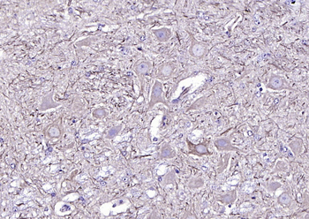 NF-L Mouse Monoclonal Antibody