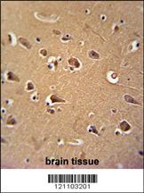 CALM1 Antibody抗体，orb1262641，bi