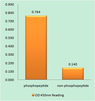 GABAA Rβ1 (phospho Ser434) rab