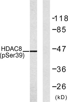 HDAC8 (phospho Ser39) rabbit p