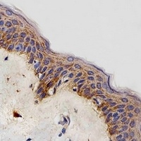 NDUFB4 Antibody抗体，orb1879771，b