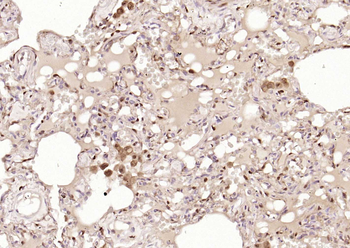 S100A4 Mouse Monoclonal Antibo