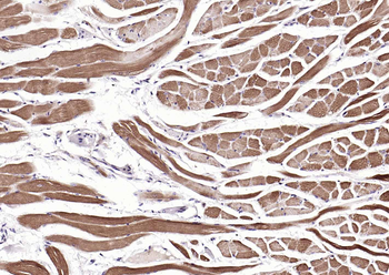 MYH1 Rabbit Polyclonal Antibod