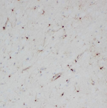 SPAG16 Antibody抗体，orb631433，bi