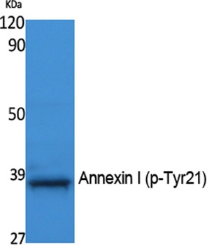 Annexin I (phospho Tyr21) rabb