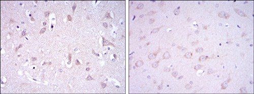 GRIA3 Antibody抗体，orb69447，bior