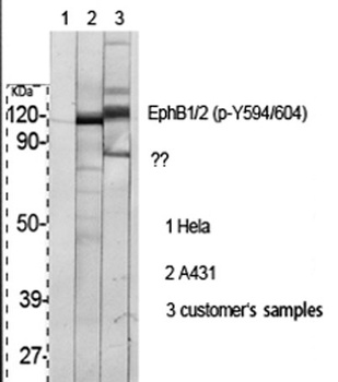 EphB1/2 (phospho Tyr594/604) r