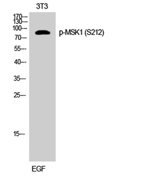 MSK1 (phospho Ser212) rabbit p