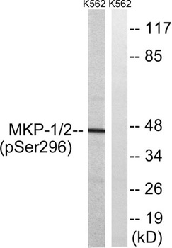 MKP-1/2 (phospho Ser296/318) r