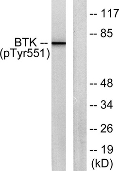 Btk (phospho Tyr551) rabbit pA