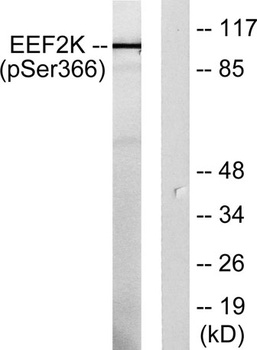 eEF2K (phospho Ser366) rabbit