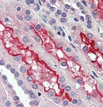 FER Antibody抗体，orb97524，biorby