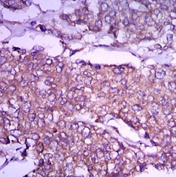 GPC3 Antibody抗体，orb97477，biorb