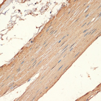 MYH11 Antibody抗体，orb1261338，bi