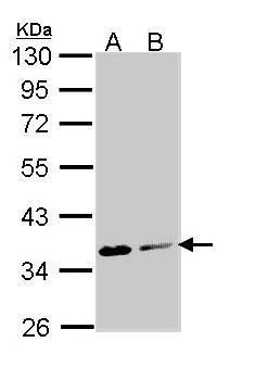 Aspartoacylase antibody [N1C3-