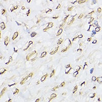 Emerin Antibody抗体，orb340731，bi