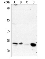 DARPP32 (Phospho-T75) Antibody