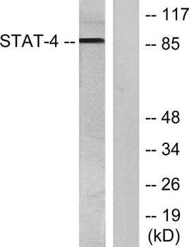 Stat4 (phospho Tyr693) rabbit 
