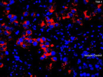 HAVCR1 Antibody抗体，orb1240149，b
