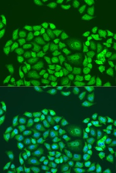 SMN2 Antibody抗体,orb1260875,bio