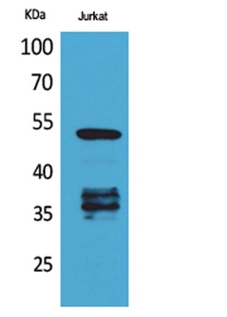 p53 (Acetyl Lys370) rabbit pAb