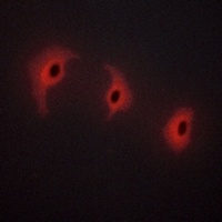 Alpha-2C Adrenergic Receptor A