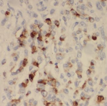 SYNJ2BP Antibody抗体，orb631678，b