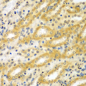 ADCK3 Antibody抗体,orb1256431,bi