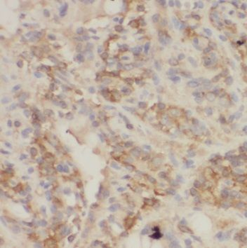 TRIM32 Antibody抗体，orb632143，bi