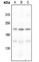 BRCA1 (Phospho-S1524) Antibody