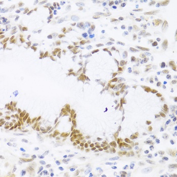 p53 Antibody抗体,orb1257920,bior