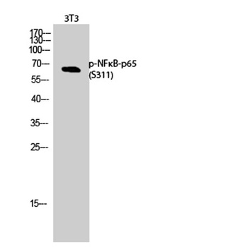 NFκB-p65 (phospho Ser311) rabb
