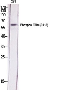 ERα (phospho Ser118) rabbit pA