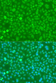 UBC Antibody抗体，orb1257914，bior