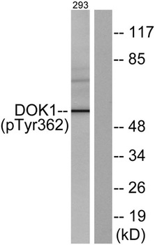 Dok-1 (phospho Tyr362) rabbit 