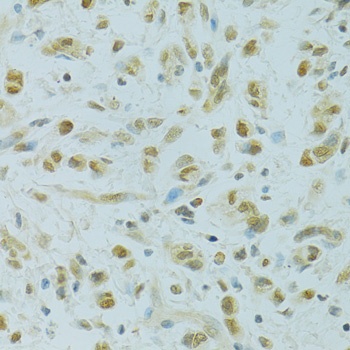 RCC1 Antibody抗体，orb1257076，bio