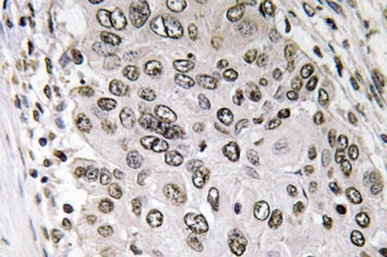 Annexin III rabbit pAb抗体，orb76