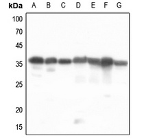 PDLIM1 Antibody [KO/KD Validat