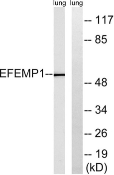 Fibulin-3 rabbit pAb抗体，orb7680