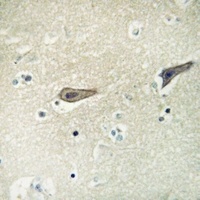 ADCK2 Antibody抗体，orb224137，bio